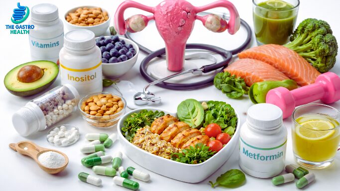 PCOS Weight Loss Vitamins